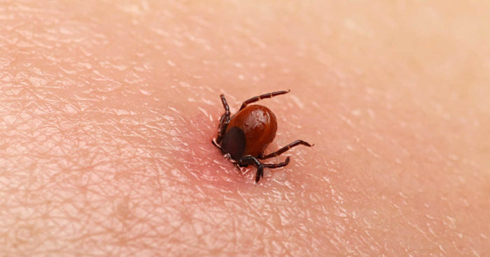 Lyme Disease Tick Canada