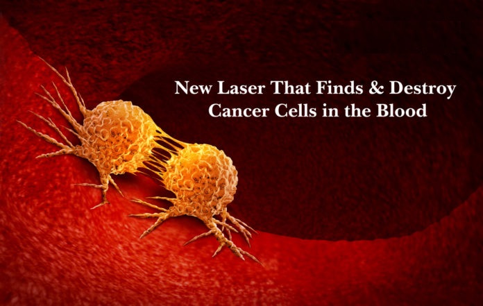 laser finds kills cancer cells in blood
